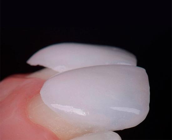 Céramique feldspathique 1